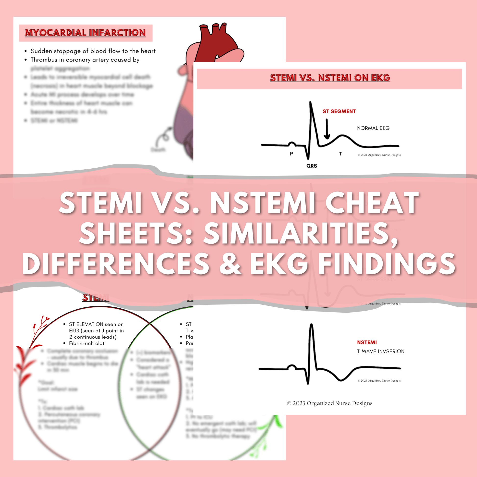 cardiac-nursing-school-study-guide-bundle-ekg-dysrhythmias-organizednursedesigns for Free Printable Ekg Study Guide Cardiac Nursing School Study Guide Bundle - EKG & Dysrhythmias – OrganizedNurseDesigns for Free Printable Ekg Study Guide