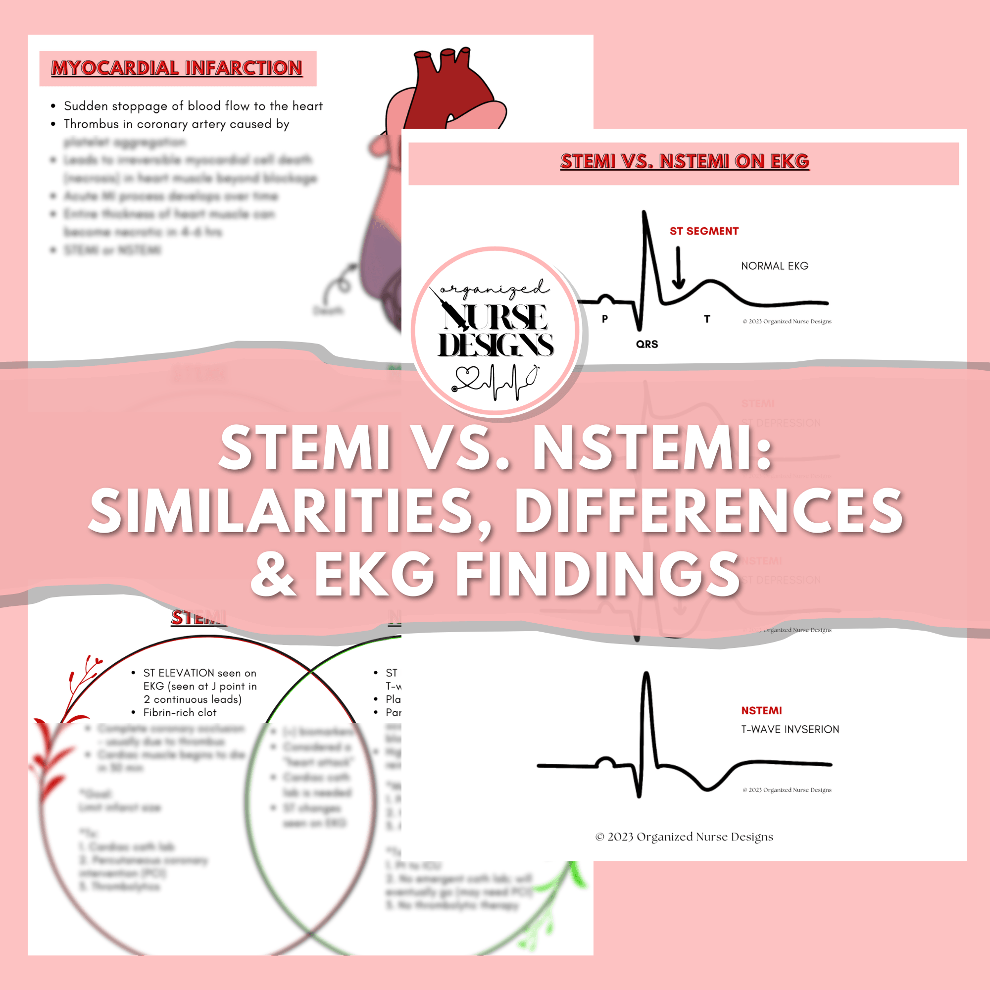 ekg cardiac study guide, stemi vs. nstemi, nursing school notes, nursing school study guide