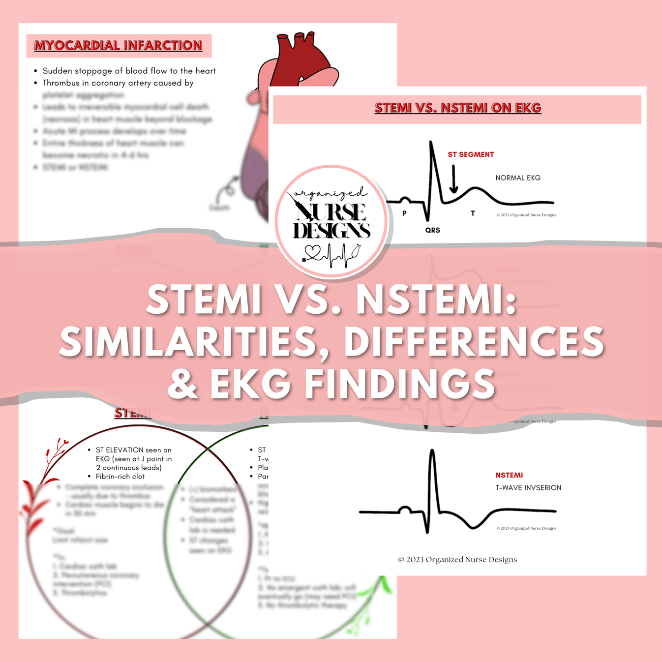 EKG Cardiac Cheat Sheets: STEMI vs. NSTEMI for Nursing Students ...